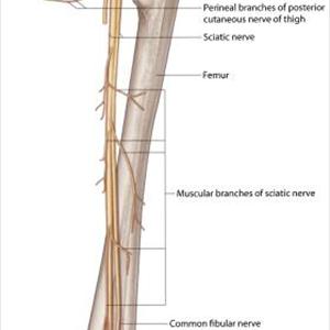 Treating Sciatic Nerve 