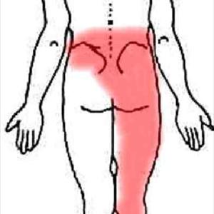  Sciatica Pain Relief Tips 