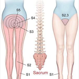  Top 7 Tips To Treat And Prevent Sciatica