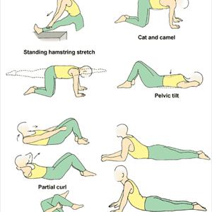 Exercises For Sciatic Problems 