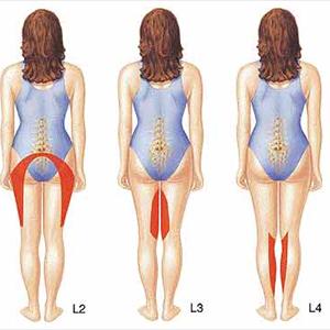 Diagram Of The Sciatic Nerve - All About Sciatica