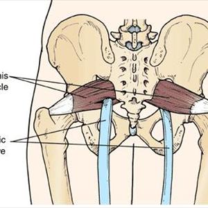 Learn To Sciatic Nerve Diagram 