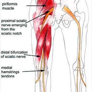 Sciatic Nerve Healing - Damn, That Pain In My ASS! (Sciatic Pain)