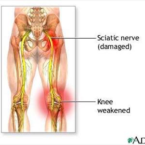 The Sciatica Relief Handbook 