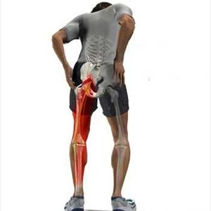  All About Sciatica